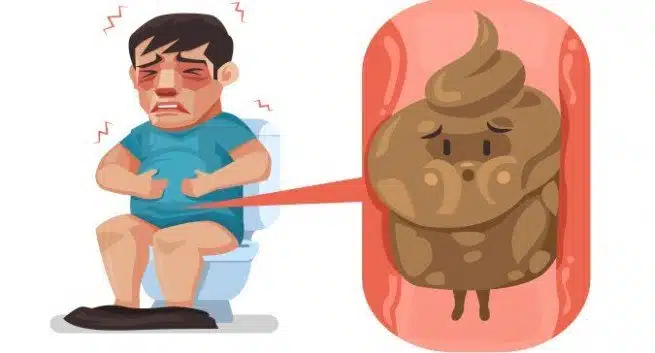 constipation